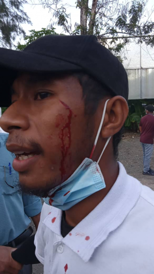 Mediku jerál Juvelino D.C. de Jesus ne&#039;ebe kanek tan ba asaun husi Estudante ne&#039;ebe Positivu Covid-19 iha suai, Segunda (19/4)