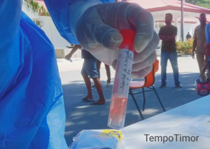 Amostra teste swab.