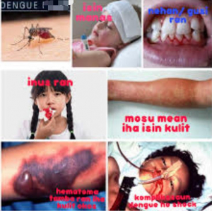 labarik sira ne&#039;ebe sofre hela Moras Dengue. 