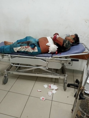 Vitima ne&#039;ebe deskonfia tiru husi Suspeitu membru PNTL ida iha Maubara hetan tratamentu ona ba nia kanek iha Ospital, Kinta (30/4)