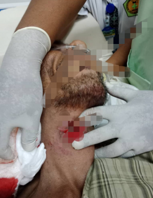 Vítima, Sanso Miguel Matos ne&#039;ebé toba hela hodi hetan atendimentu husi mediku sira, kinta (10/02). 
