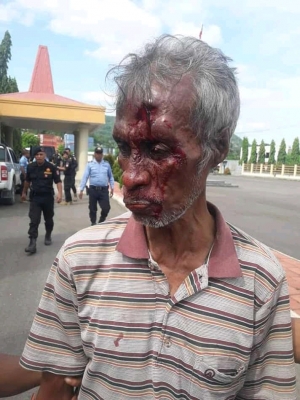 Veteranu Kombatente Libretasaun Nasional ida ne&#039;ebe hetan baku husi ema balun ate hetan kanek iha rentos, Rei kadalak halo keixa ba iha PNTL parte BOP iha Bairo Pite Dili (2/3)